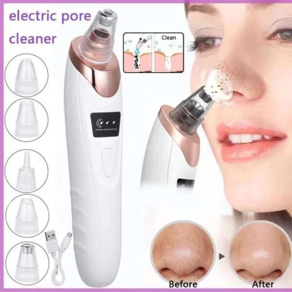 Blackhead Remover - Image 5